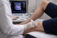 Діагностика варикозного розширення вен: коли потрібне УЗД вен нижніх кінцівок і які симптоми не варто ігнорувати