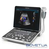 Як обрати портативний УЗД-апарат: ключові критерії